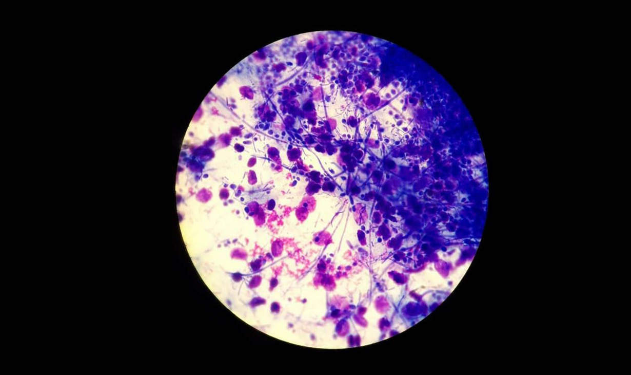 Genital Infections Dr Jillian Pritchard MA (Oxon), FRCOG, DCH