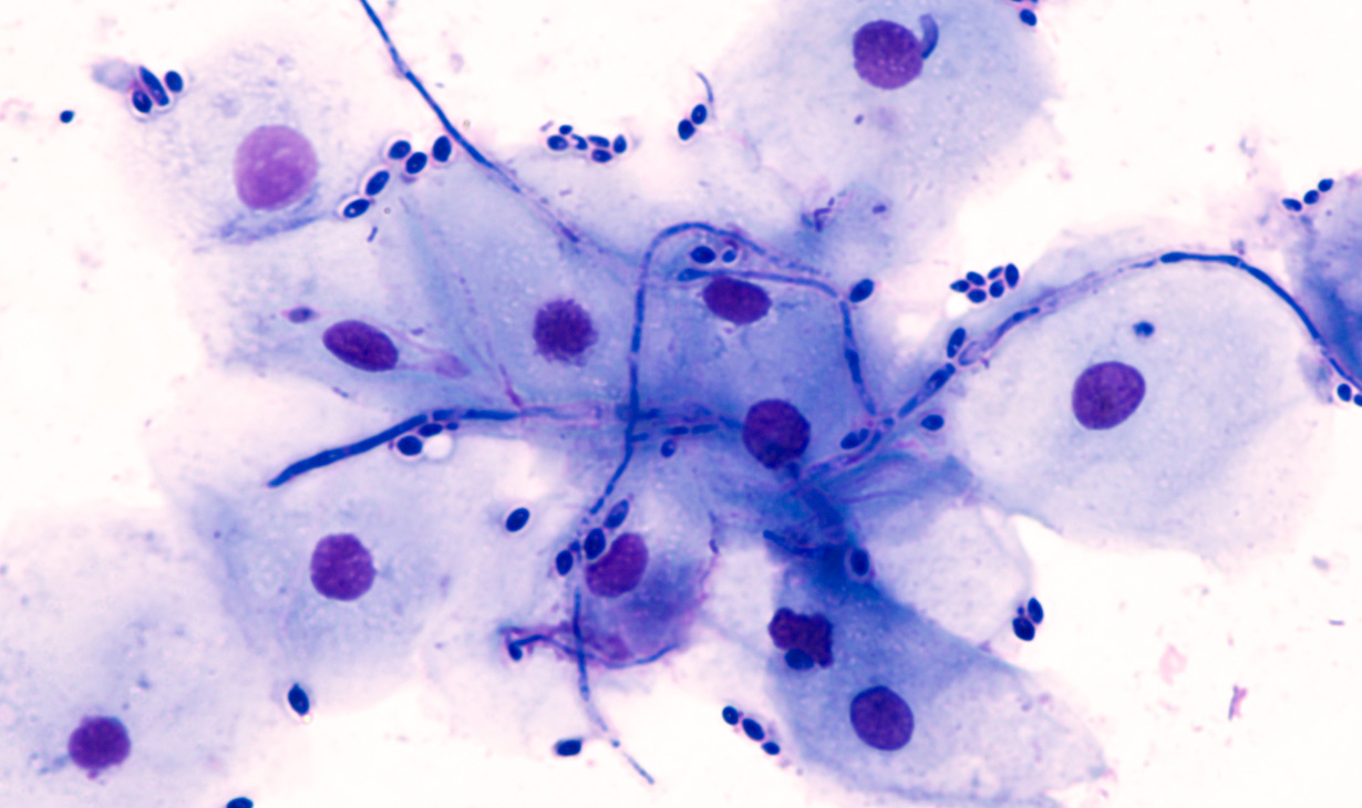 Genital Infections Dr Jillian Pritchard MA (Oxon), FRCOG, DCH